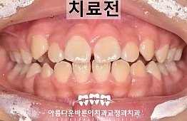 수술전