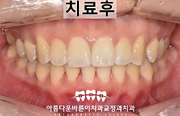 수술후