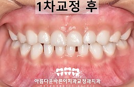 수술후