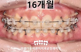 수술후