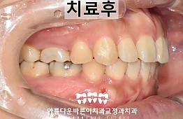 수술후