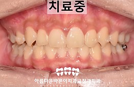 수술후