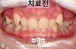 수술전