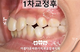 수술후