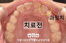 수술전