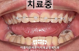 수술후
