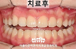 수술후