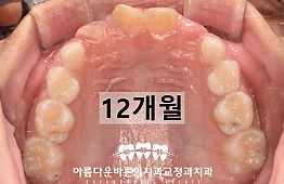 수술후