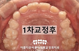 수술후