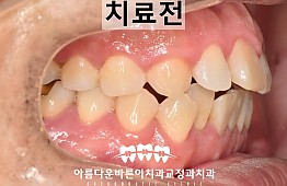 수술전