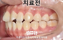 수술전