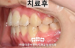 수술후