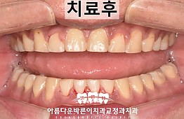 수술후