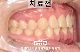 수술전