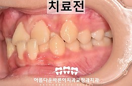 수술전