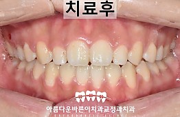 수술후