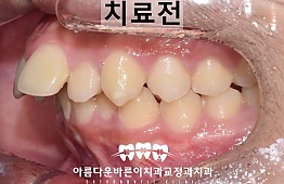 수술전