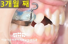 수술후