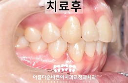 수술후