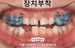 수술후