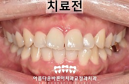 수술전