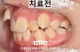 수술전