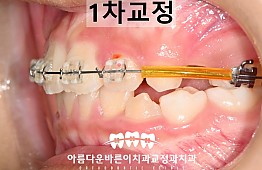 수술후
