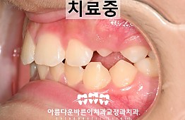 수술후