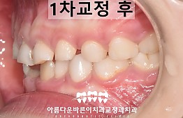수술후