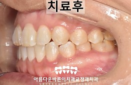 수술후