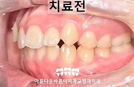 수술전