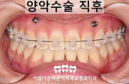 수술후