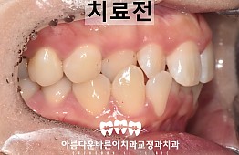 수술전