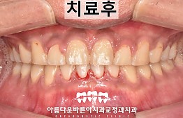 수술후