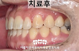 수술후