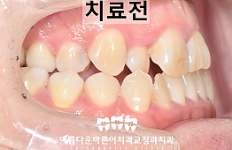 수술전