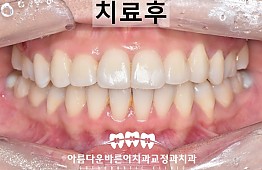 수술후