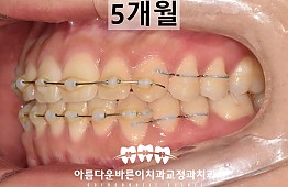 수술후