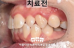 수술전