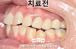 수술전