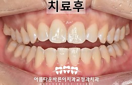 수술후