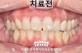 수술전