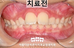 수술전