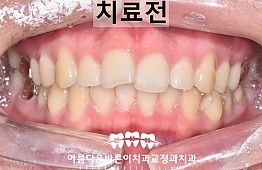 수술전