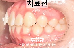 수술전