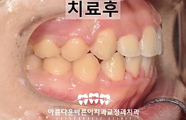 수술후