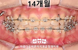 수술후