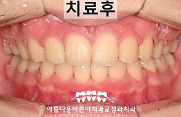 수술후