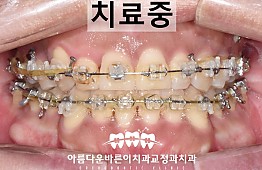 수술후