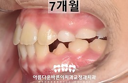 수술후